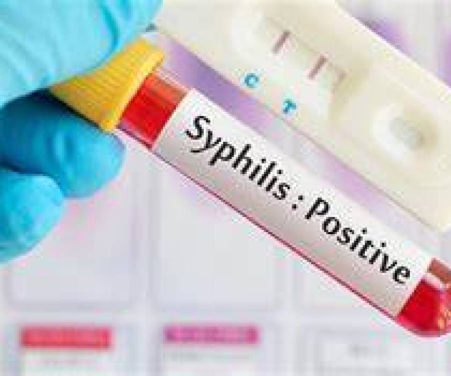Los casos de infección de sífilis aumentan en los jóvenes